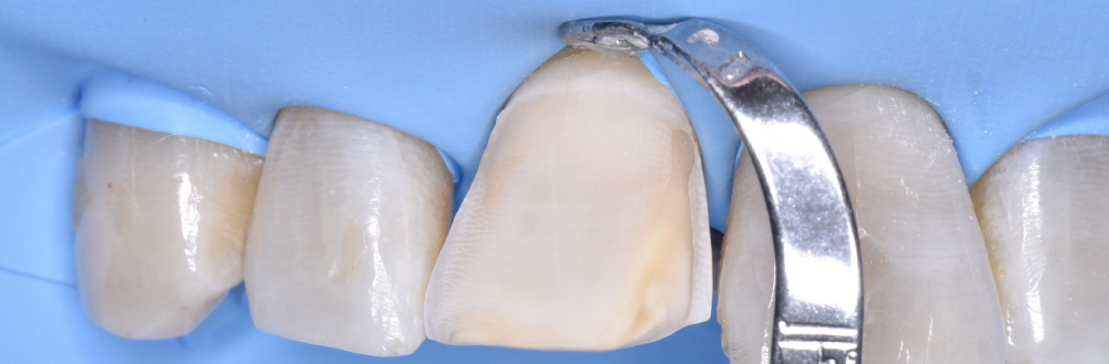 estetica dental