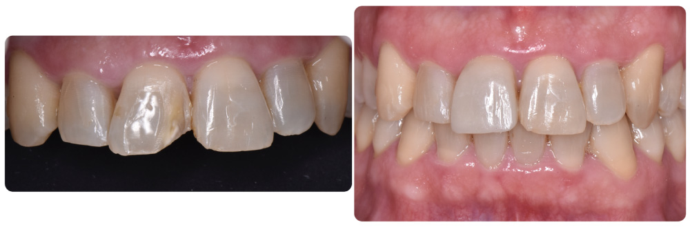 estetica dental