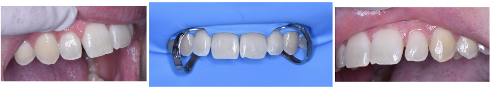 estetica dental