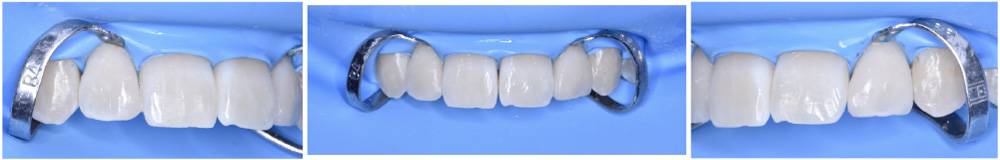 estetica dental