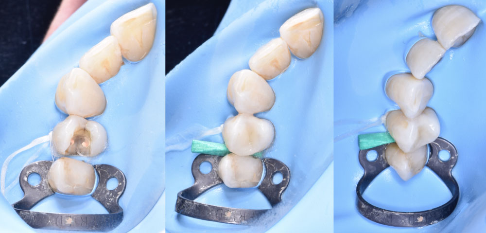 odontologia restauradora