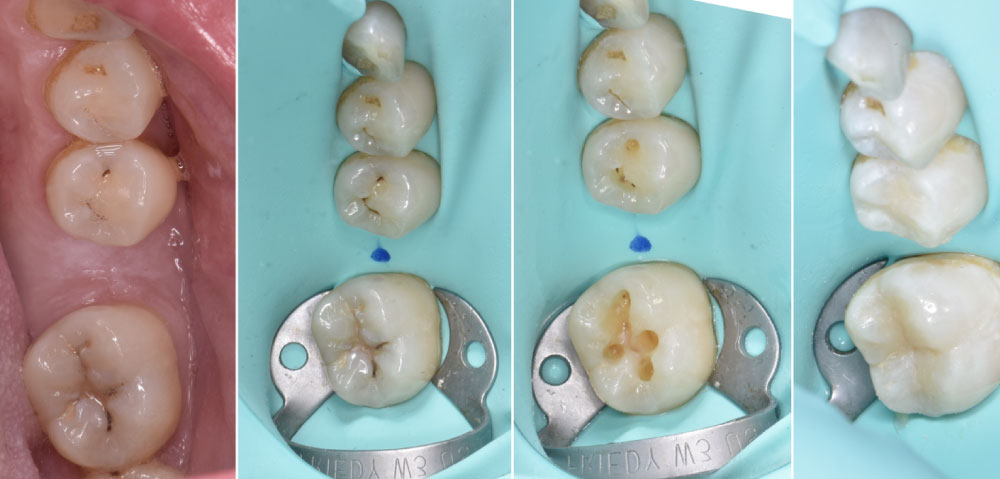 odontologia restauradora