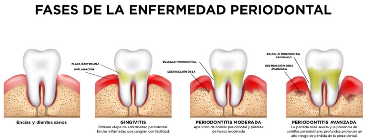 periodoncia