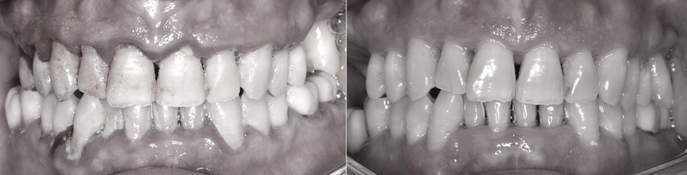 periodoncia