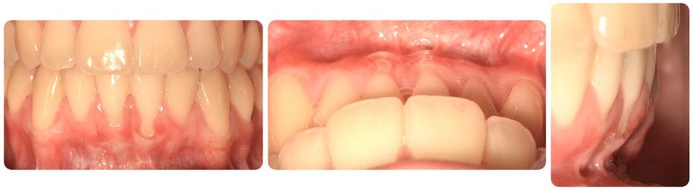 periodoncia