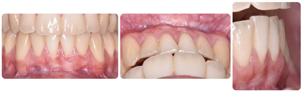 periodoncia