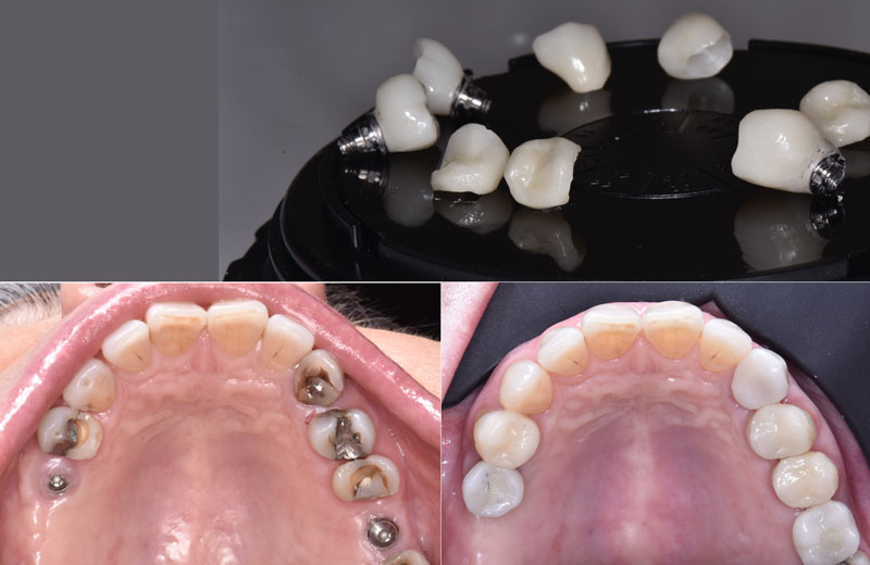 cirugia bucal