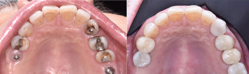 Inicio 12 Cirugía bucal e implantes