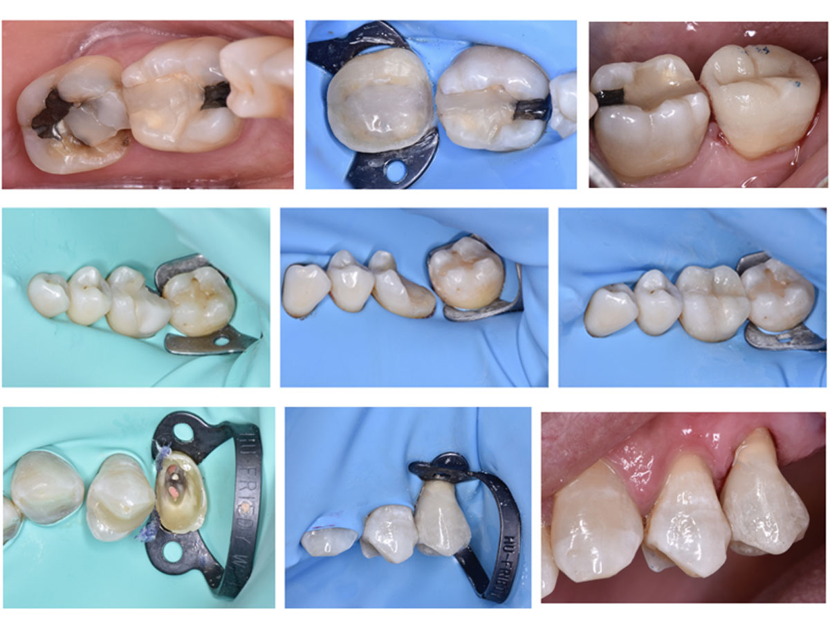 cohen ovelar dental
