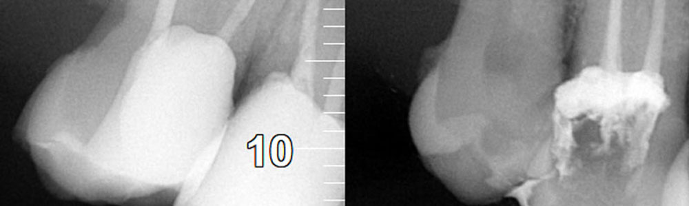 Inicio 10 Endodoncia