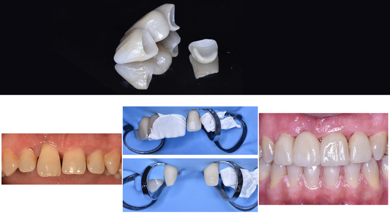 estetica dental