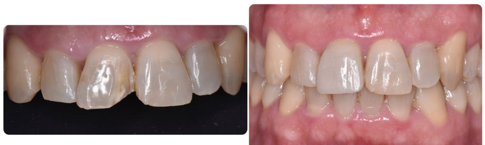 Inicio 11 Estética dental