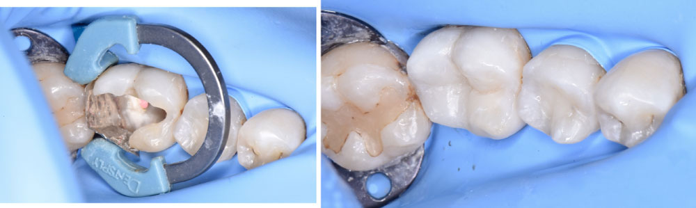 Inicio 8 Odontología restauradora