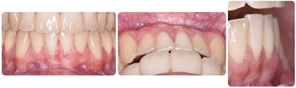 Inicio 9 Periodoncia